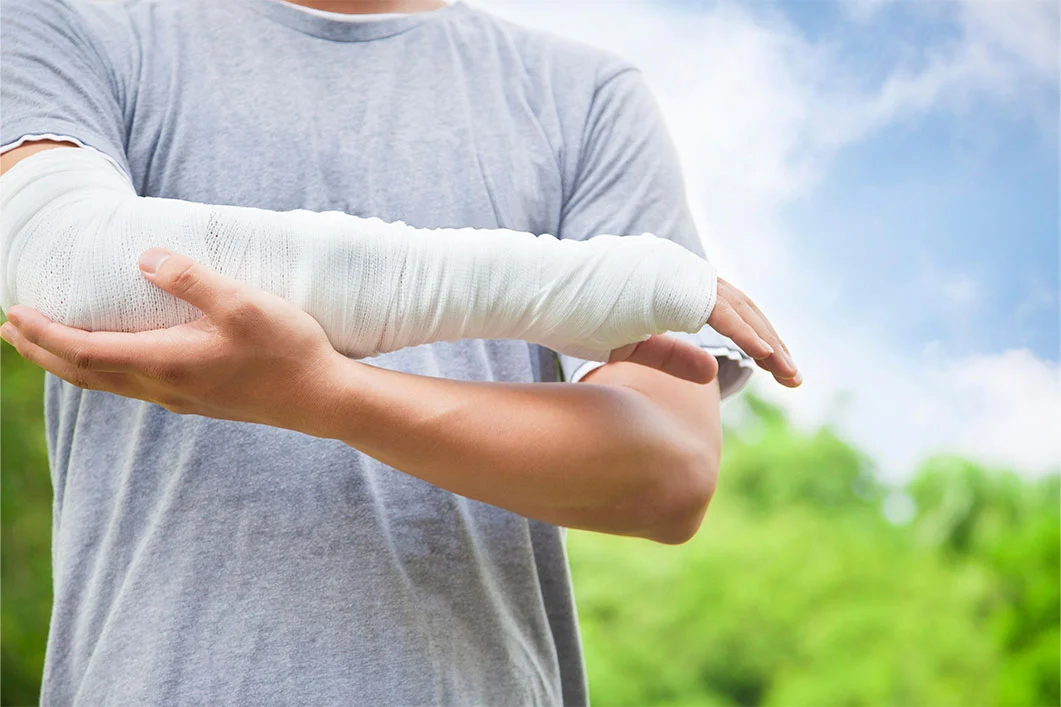 Amputation Litigation Expertise